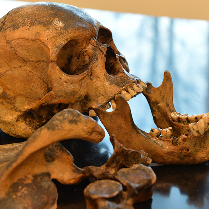 human skull